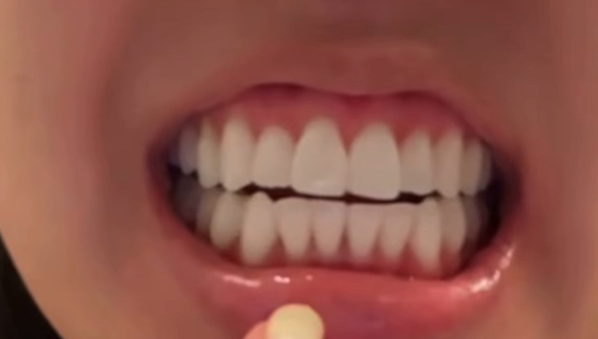 LumoSmile real result 4