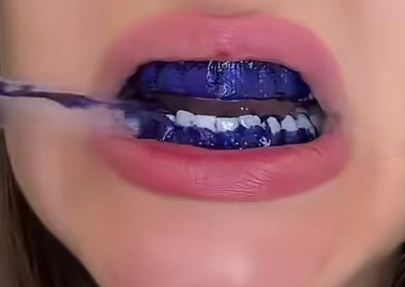 LumoSmile real result 5